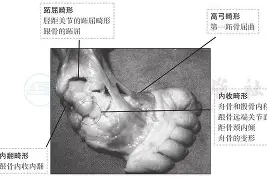跗骨之蛆有多恶心?对手打越狠反伤越疼的机制 跗骨之蛆有多恶心?对手打越狠反伤越疼的机制